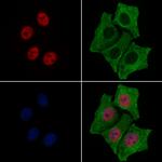Phospho-Estrogen Receptor alpha (Ser118) Antibody in Immunocytochemistry (ICC/IF)