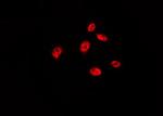 Phospho-p53 (Ser315) Antibody in Immunocytochemistry (ICC/IF)