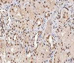 Phospho-p53 (Ser315) Antibody in Immunohistochemistry (Paraffin) (IHC (P))