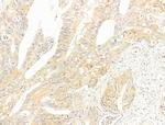 Phospho-LCK (Tyr505) Polyclonal Antibody