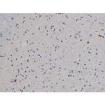Phospho-Lyn (Tyr508) Antibody in Immunohistochemistry (Paraffin) (IHC (P))
