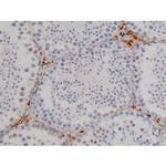 Phospho-Lyn (Tyr508) Polyclonal Antibody