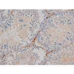 Phospho-BCL-2 (Ser70) Polyclonal Antibody