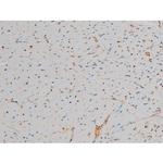 Phospho-GATA1 (Ser142) Antibody in Immunohistochemistry (Paraffin) (IHC (P))
