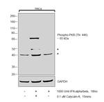 Phospho-PKR (Thr446) Antibody in Western Blot (WB)
