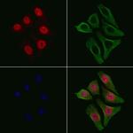 Phospho-NFkB p105/p50 (Ser907) Polyclonal Antibody