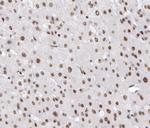 Phospho-Cyclin E (Thr395) Antibody in Immunohistochemistry (Paraffin) (IHC (P))