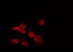 Phospho-PI3K p85/p55 (Tyr458, Tyr199) Antibody in Immunocytochemistry (ICC/IF)