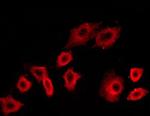 Phospho-PI3K p85/p55 (Tyr458, Tyr199) Antibody in Immunocytochemistry (ICC/IF)