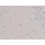Phospho-CDC25A (Thr507) Antibody in Immunohistochemistry (Paraffin) (IHC (P))