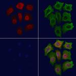 Phospho-p21 (Thr145) Polyclonal Antibody