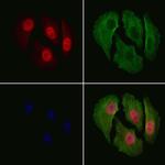 Phospho-p27 Kip1 (Thr198) Antibody in Immunocytochemistry (ICC/IF)