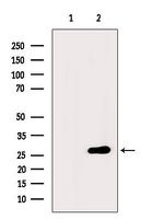 Phospho-p27 Kip1 (Thr198) Antibody in Western Blot (WB)