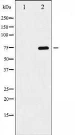 Phospho-NFkB p65 (Ser468) Antibody in Western Blot (WB)