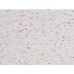 Phospho-PKC theta (Ser676) Antibody in Immunohistochemistry (Paraffin) (IHC (P))