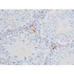 Phospho-PKC theta (Ser676) Polyclonal Antibody