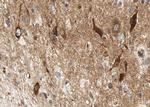 Phospho-HSL (Ser552) Polyclonal Antibody