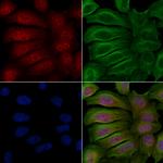 Phospho-PKC delta (Ser645) Polyclonal Antibody