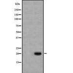 Caspase 1 p20 (Cleaved Asp296) Antibody in Western Blot (WB)