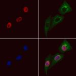 RING1 Polyclonal Antibody