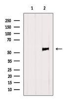 RING1 Antibody in Western Blot (WB)