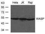 WASP Polyclonal Antibody