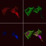 TWIST2 Polyclonal Antibody