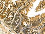 IL-5 Antibody in Immunohistochemistry (Paraffin) (IHC (P))