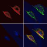 Aquaporin 5 Polyclonal Antibody