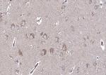 BMP-6 Polyclonal Antibody