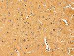 IL-11 Antibody in Immunohistochemistry (Paraffin) (IHC (P))
