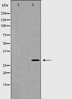 HOXB5 Polyclonal Antibody
