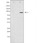SOX6 Polyclonal Antibody