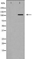 EphA5 Polyclonal Antibody