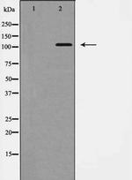 EphB1 Polyclonal Antibody