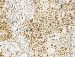 hnRNP H1 Antibody in Immunohistochemistry (Paraffin) (IHC (P))
