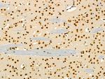 hnRNP H1 Antibody in Immunohistochemistry (Paraffin) (IHC (P))
