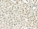 hnRNP H1 Antibody in Immunohistochemistry (Paraffin) (IHC (P))
