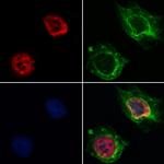 hnRNP H1 Polyclonal Antibody