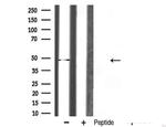 hnRNP H1 Antibody in Western Blot (WB)