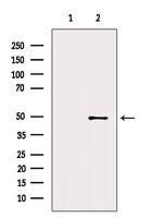hnRNP H1 Antibody in Western Blot (WB)