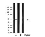 hnRNP H1 Antibody in Western Blot (WB)