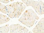 alpha Actinin 2/3 Antibody in Immunohistochemistry (Paraffin) (IHC (P))