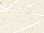 alpha Actinin 2/3 Antibody in Immunohistochemistry (Paraffin) (IHC (P))