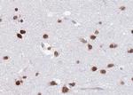 hnRNP C1/C2 Antibody in Immunohistochemistry (Paraffin) (IHC (P))