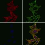 Kir6.2 (KCNJ11) Polyclonal Antibody