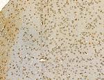 MKL1 Antibody in Immunohistochemistry (Paraffin) (IHC (P))
