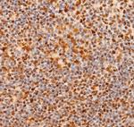 NOTCH1 (Cleaved Val1744) Polyclonal Antibody