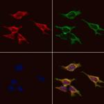 GPR91 Antibody in Immunocytochemistry (ICC/IF)