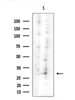 GPR91 Antibody in Western Blot (WB)